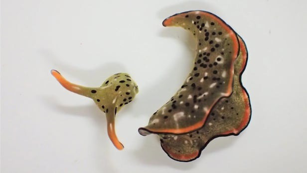 Ngoài ra, cả ốc và con người đều sử dụng những gene giống nhau để hình thành mắt, trong đó có gene PAX6. Ảnh: Nation Women’s Hospital.