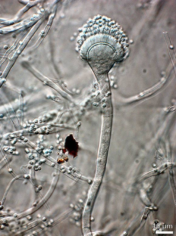 Tuy nhiên, bào tử nấm có thể phát triển sâu trong cơ thể, gây bệnh Aspergillosis lên những cá nhân đang mắc các bệnh lý về đường hô hấp như bệnh phổi tiềm ẩn, hen suyễn, những người bị suy yếu hệ miễn dịch do đang điều trị ung thư, ghép tạng, hay mắc HIV/AIDS... Theo các chuyên gia, bệnh nhiễm nấm Aspergillus có tỉ lệ tử vong rất cao (20 - 40%) và thường khó chẩn đoán được. Ảnh: Aspergillus felis (Barrs VR et al).
