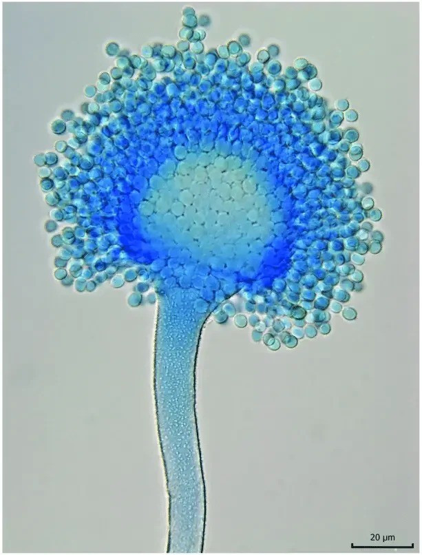 Các độc tố trong loại nấm Aspergillus flavus có thể dẫn đến nhiễm trùng phổi, đặc biệt là ở những người có hệ thống miễn dịch dễ bị tổn thương. Ảnh: Vladimir Ostry.