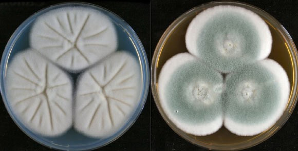 Nghiên cứu của các chuyên gia chỉ ra 2 loài nấm là Aspergillus flavus và Aspergillus fumigatus dự kiến có thể sẽ lan rộng sang một số vùng của Mỹ, Canada, châu Âu và Bắc Á vào năm 2100. Ngược lại, một số khu vực ở Nam Mỹ, châu Phi và Australia có thể trở nên quá nóng làm tăng khả năng chịu đựng của nấm, cho phép chúng tồn tại lâu hơn trong cơ thể người. Ảnh: Barrs VR et al.