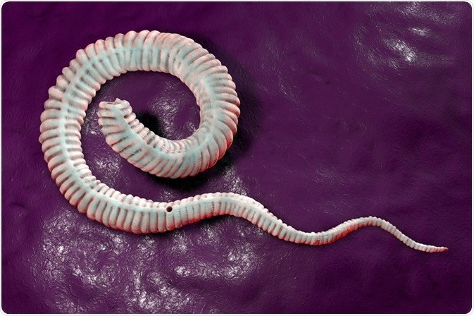 Sau khi thâm nhập vào cơ thể người, Dracunculus medinensis sẽ gây ra những cơn đau thường xuyên bởi chúng gặm nhấm dần phần thịt của vật chủ, để đẻ trứng. Ảnh: Kateryna Kon / Shutterstock.com.