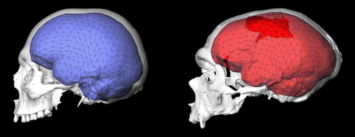 Neanderthal là một loài người cổ đại đã tuyệt chủng, cùng thuộc chi Homo (chi Người) với người Homo sapiens chúng ta và đã từng giao phối dị chủng với tổ tiên chúng ta. Người hiện đại mang khoảng trên dưới 2% ADN của các vị tổ tiên khác loài này. Ảnh: Simon Neubauer/Philipp Gunz.