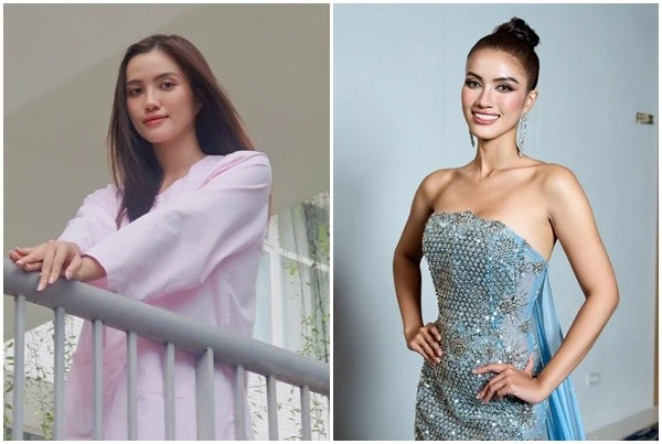 Á hậu Minh Nhàn chia sẻ về chuyến "nghỉ dưỡng" bất đắc dĩ ở bệnh viện