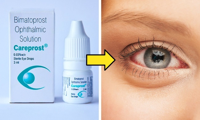 1. Một trong những mẹo làm đẹp trên mạng được chia sẻ nhiều là sử dụng thuốc Careprost: Đây là thuốc dành cho bệnh nhân tăng nhãn áp, có nhiều người cho rằng sử dụng sẽ dài mi hơn, song nhiều người sử dụng thuốc này nhận thấy không có bất cứ thay đổi gì.