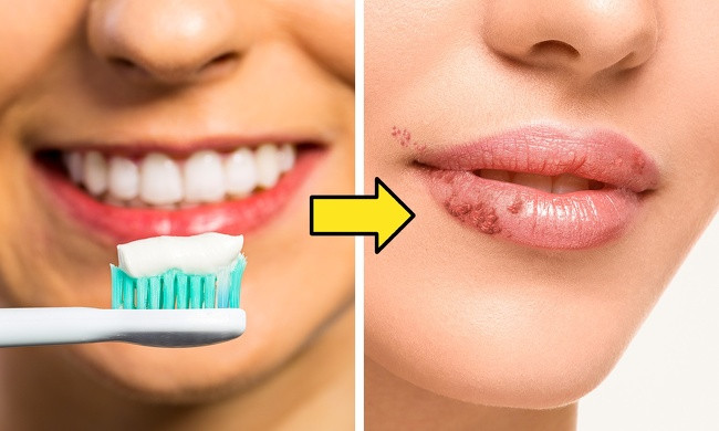 2. Dùng bàn chải đánh răng cho môi: Đây là mẹo tẩy da chết môi nhưng có thể làm cho da môi bị tổn thương và vi khuẩn có thể xâm nhập.
