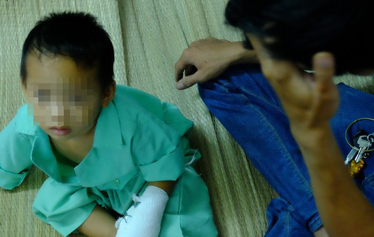 Nghịch máy xay bột làm nhang, bé trai 3 tuổi đứt lìa ba ngón tay: Ngày 16/1/2018, Bệnh viện Chấn thương Chỉnh hình TP.HCM tiếp nhận điều trị cho trường hợp bé N.C.T (3 tuổi, ngụ huyện Ba Tri, tỉnh Bến Tre) bị tai nạn sinh hoạt rất nặng. Theo lời kể của người nhà, ít ngày trước, khi đang được ông nội cho ăn cơm, bé T. chạy đến chỗ máy xay bột làm nhang bán Tết chơi đùa. Khi bà nội nghe tiếng khóc và phát hiện bé cho tay vào máy thì đã muộn. Phần đĩa sên trên máy đã nghiến đứt lìa bàn tay trái đứa trẻ.