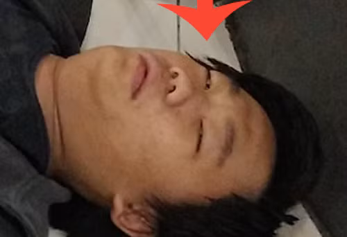 Vạch mặt trai trẻ đi muôn nơi giả ngất để ăn xin 