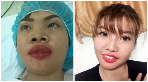 Hé lộ thêm ảnh lột xác đau đớn của "Thị Nở tái sinh"