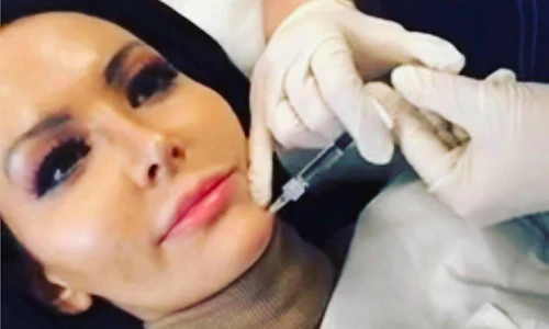 Cận cảnh những lần dao kéo của cô gái nghiện phẫu thuật thẩm mỹ