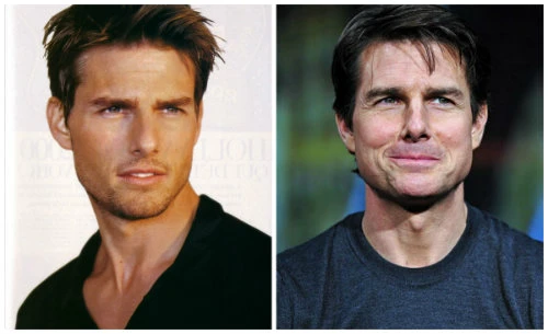 Mỹ nam Hollywood xấu tệ vì tăng cân, hói đầu