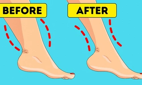 7 mẹo sở hữu đôi chân thon thả tự tin diện váy mùa hè