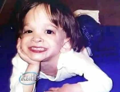 Cô gái 20 với cơ thể bé 4 tuổi qua đời