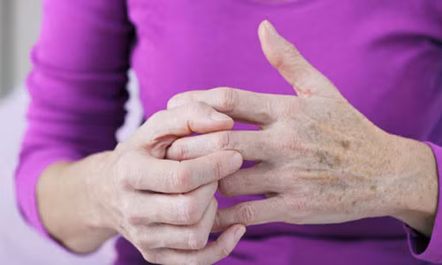 Ngăn ngừa viêm khớp, tránh 8 thực phẩm sau ngay từ bây giờ