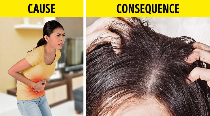 Dấu hiệu mái tóc cảnh báo sức khoẻ bạn có vấn đề