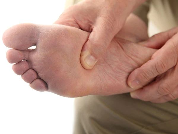 Cách trị chứng loét chân do bệnh tiểu đường