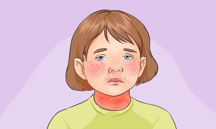 Cách nhận biết 10 bệnh thường gặp ở trẻ nhỏ