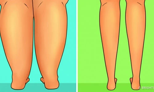 11 bài tập giúp bắp chân thon gọn siêu tốc