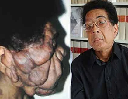 Những ca phẫu thuật khó tin trong lịch sử