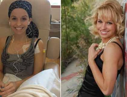 Người đẹp Mỹ chống chọi ung thư buồng trứng hiếm 