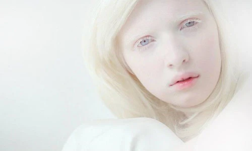 Vẻ đẹp của nàng “Bạch Tuyết” 9X người Nga