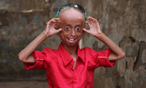 Xót xa cậu bé già như ông lão 60 dù mới 11 tuổi