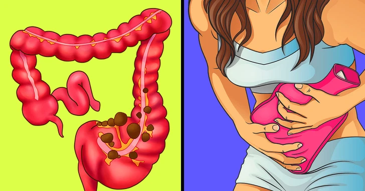 9 cách hiệu quả giảm đau dạ dày nhanh chóng không cần tới thuốc