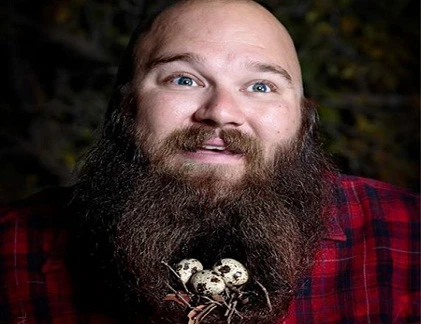 Những tác dụng mới "khó đỡ" của bộ râu