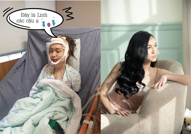 Hết hồn với loạt ảnh cận cảnh quá trình chuyển giới của Lynk Lee