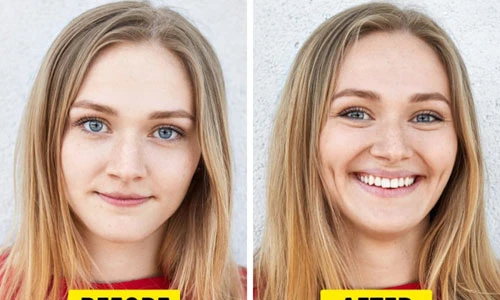 Những loại phẫu thuật thẩm mỹ kỳ lạ đang thịnh hành