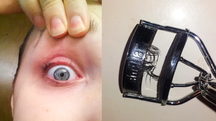 Những thảm họa làm đẹp khiến chị em sợ tới già