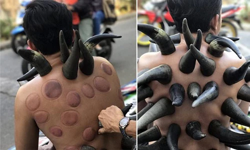 Kinh ngạc trước phương pháp chữa bệnh bằng sừng trâu 