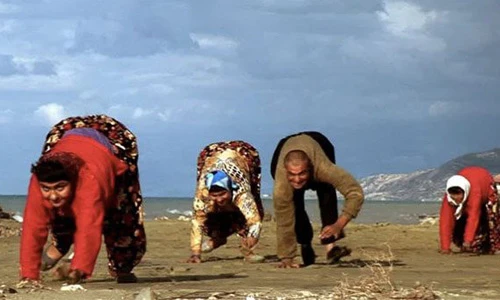 Những trường hợp dị dạng kỳ lạ của con người