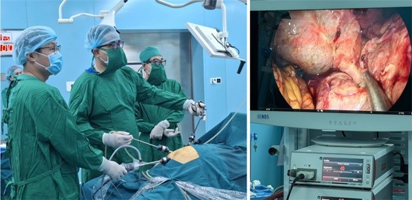 Bác sĩ đang nội soi thám sát ổ bụng người bệnh P.M.Q. Ảnh: Bệnh viện Bình Dân y-te-con-dao-1.jpg