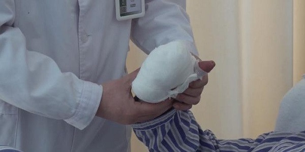 Say rượu rồi gục bên đường, người đàn ông mất 4 ngón tay Say ruou roi guc ben duong, nguoi dan ong mat 4 ngon tay