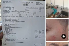 Điều tra vụ Hiệu trưởng và giáo viên xô xát trong tiệc liên hoan 20/11