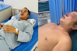 Khởi tố 3 kẻ hành hung hai anh em giúp người gặp nạn