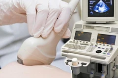 400 phụ nữ được tầm soát ung thư vú miễn phí