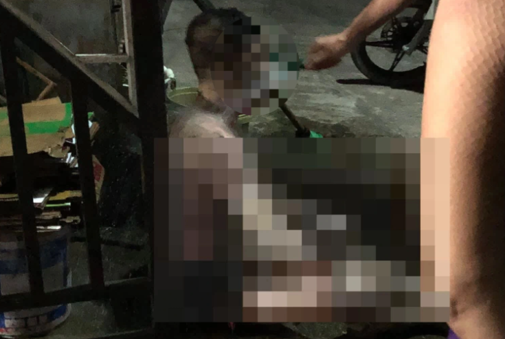 Người đàn ông tự thiêu khiến cơ thể bị bỏng nặng. capture-2049.png