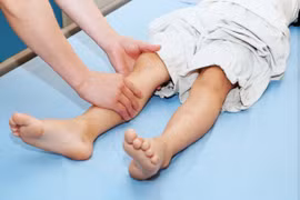 Trẻ bị đau chân sau sốt cao do biến chứng tiêu cơ vân nguy hiểm