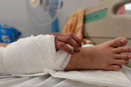 Kỳ tích ghép tay vào chân để cứu tay đứt lìa cho thai phụ 20 tuổi