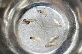 Không chú ý vệ sinh, ổ dòi làm tổ trong hốc mũi 