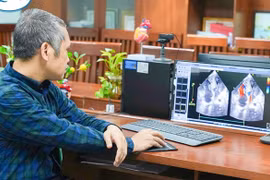 Ba lần mổ cứu sống trẻ tim bẩm sinh phức tạp, tái tạo thành công tim hai thất