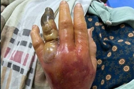 View - Hành trình cam go giữ sự sống cho sản phụ rau cài răng lược | Báo Tri thức và Cuộc sống - TIN TỨC PHỔ BIẾN KIẾN THỨC 24H