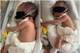 Hồi sinh sự sống cho trẻ 1,4 kg sinh non, suy hô hấp nguy kịch