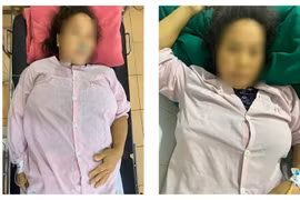 Sản phụ người Mông 2 lần nguy kịch vì tự ý dùng thuốc phá thai tại nhà