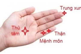 Kích thích huyệt phục hồi tóc rụng sau sốt xuất huyết