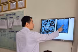 Chủ quan sỏi thận không đau, không điều trị, người bệnh bị suy thận nặng