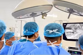 Tạo van bán vòng điều trị bệnh co thắt tâm vị gây biến chứng nghiêm trọng