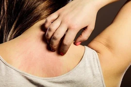 Món ăn bài thuốc phòng chữa ngứa da mùa hè