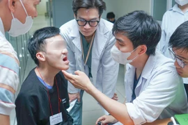 Phẫu thuật miễn phí cho trẻ dị tật khe hở môi, vòm miệng